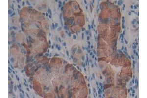 Immunohistochemistry (IHC) image for anti-Fibrinogen gamma Chain (FGG) (AA 166-416) antibody (ABIN7434950)