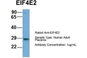Host: Rabbit  Target Name: EIF4E2  Sample Tissue: Human Adult Placenta  Antibody Dilution: 1. (EIF4E2 抗体  (N-Term))