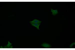 Detection of CASP7 in Human MCF7 cell using Polyclonal Antibody to Caspase 7 (CASP7) (Caspase 7 抗体  (AA 207-303))