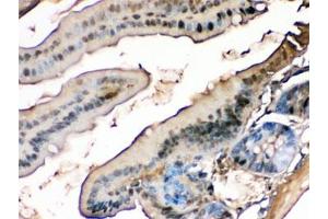 IHC testing of FFPE mouse intestine with FABP antibody. (FABP1 (liver) 抗体)