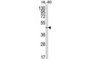 Western Blotting (WB) image for anti-UDP-Gal:betaGlcNAc beta 1,4 Galactosyltransferase, Polypeptide 1 (B4GALT1) antibody (ABIN3003951) (B4GALT1 抗体)