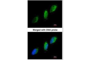 ICC/IF Image Immunofluorescence analysis of paraformaldehyde-fixed HeLa, using TYK2, antibody at 1:200 dilution. (TYK2 抗体)