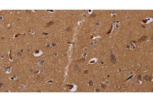 Immunohistochemistry of paraffin-embedded Human brain using MOB1A Polyclonal Antibody at dilution of 1:30 (MOB1A 抗体)