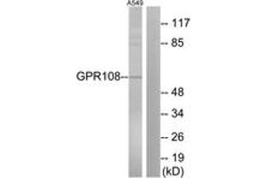 Western blot analysis of extracts from A549 cells, using GPR108 Antibody. (GPR108 抗体  (AA 155-204))