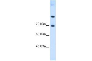 WB Suggested Anti-SLC7A4 Antibody Titration:  0. (SLC7A4 抗体  (Middle Region))
