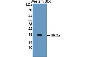 Western blot analysis of the recombinant protein. (DUSP5 抗体  (AA 1-135))