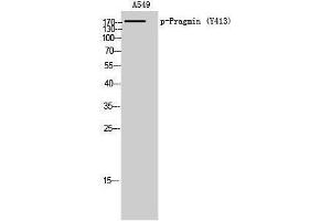 Western Blotting (WB) image for anti-Tyrosine-Protein Kinase SgK223 (SGK223) (pTyr413) antibody (ABIN3172968) (PRAGMIN 抗体  (pTyr413))