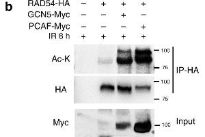 Western Blotting (WB) image for anti-Acetylated Lysine antibody (ABIN5596809)