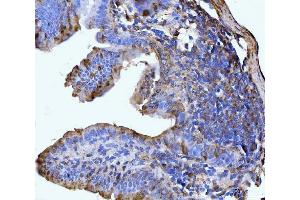 IHC analysis of GLUL using anti-GLUL antibody (ABIN7602403).