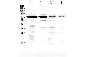 Western blot analysis of IBSP using anti-IBSP antibody . (IBSP 抗体)