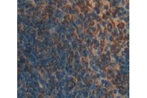 Used in DAB staining on fromalin fixed paraffin- embedded Kidney tissue (DC-SIGN/CD209 抗体  (AA 115-238))