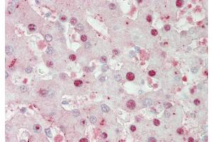 Immunohistochemistry with Liver cell lysate tissue (ATOH1 抗体  (Middle Region))