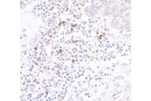 Immunohistochemistry (IHC) image for anti-Tumor Necrosis Factor Receptor Superfamily, Member 4 (TNFRSF4) (AA 29-216) antibody (ABIN7454031)