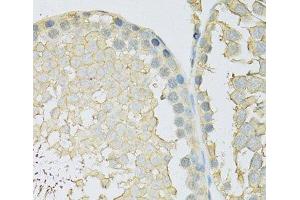 Immunohistochemistry of paraffin-embedded Rat testis using SLC2A9 Polyclonal Antibody at dilution of 1:100 (40x lens). (SLC2A9 抗体)