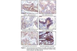 Image no. 1 for anti-Insulin-Like Growth Factor 1 Receptor (IGF1R) antibody (ABIN232138) (IGF1R 抗体)