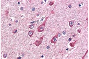Human Brain, Cortex (formalin-fixed, paraffin-embedded) stained with OGT antibody ABIN337257 at 5 ug/ml followed by biotinylated anti-goat IgG secondary antibody ABIN481715, alkaline phosphatase-streptavidin and chromogen. (OGT 抗体  (AA 543-555))