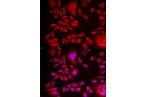 Immunofluorescence analysis of HeLa cells using BLMH antibody (ABIN6127522, ABIN6137574, ABIN6137575 and ABIN6222197). (BLMH 抗体  (AA 1-300))