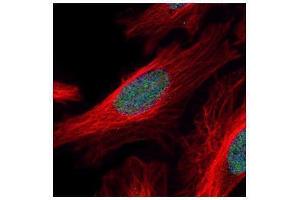 ICC/IF Image Confocal immunofluorescence analysis (Olympus FV10i) of paraformaldehyde-fixed HeLa, using ZNF38, antibody (Green) at 1:500 dilution. (ZSCAN21 抗体)
