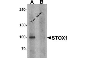 Western Blotting (WB) image for anti-Storkhead Box 1 (STOX1) (C-Term) antibody (ABIN1030709) (STOX1 抗体  (C-Term))