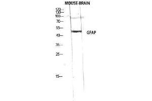 Western Blotting (WB) image for anti-Glial Fibrillary Acidic Protein (GFAP) (Ser423) antibody (ABIN3184781) (GFAP 抗体  (Ser423))