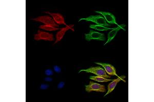 ABIN6261365 and ABIN6272687 staining HepG2 cells by IF/ICC.