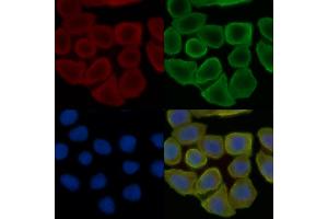 ABIN6257034 and ABIN6275778 staining Hela cells(30 min of UV treatment) by IF/ICC. (KRT37,38 (C-Term) 抗体)