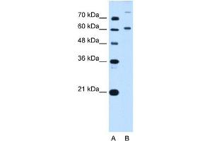 BMP2K antibody used at 5 ug/ml to detect target protein. (BMP2K 抗体  (C-Term))