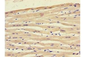 Immunohistochemistry of paraffin-embedded human heart tissue using ABIN7151354 at dilution of 1:100 (ART5 抗体  (AA 45-291))