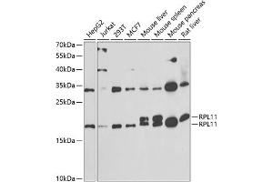 Western blot analysis of extracts of various cell lines, using RPL11 antibody (ABIN6129101, ABIN6147106, ABIN6147108 and ABIN6222040) at 1:1000 dilution. (RPL11 抗体  (AA 1-177))