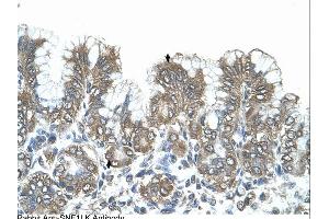 Immunohistochemistry (IHC) image for anti-Salt-Inducible Kinase 1 (SIK1) (N-Term) antibody (ABIN2782413) (SIK1 抗体  (N-Term))