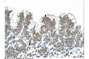 Immunohistochemistry (IHC) image for anti-Salt-Inducible Kinase 1 (SIK1) (N-Term) antibody (ABIN310741)
