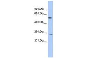 Image no. 1 for anti-Retinal Degeneration 3 (RD3) (AA 35-84) antibody (ABIN6743901) (RD3 抗体  (AA 35-84))