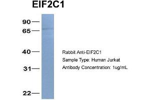 Host: Rabbit Target Name: EIF2C1 Sample Type: Jurkat Antibody Dilution: 1. (AGO1 抗体  (N-Term))