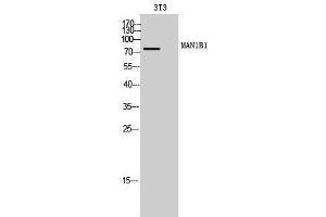 Western Blotting (WB) image for anti-Mannosidase, Alpha, Class 1B, Member 1 (MAN1B1) (Internal Region) antibody (ABIN6280683)