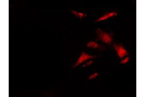 ABIN6272439 staining 293 by IF/ICC. (TNKS1BP1 抗体  (C-Term))
