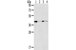 Gel: 8 % SDS-PAGE,Lysate: 40 μg,Lane 1-4: 293T cells, K562 cells, Lovo cells, Human bladder carcinoma tissue,Primary antibody: ABIN7191340(MAGEA11 Antibody) at dilution 1/200 dilution,Secondary antibody: Goat anti rabbit IgG at 1/8000 dilution,Exposure time: 30 seconds (MAGEA11 抗体)