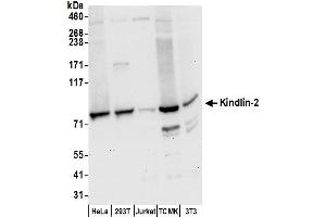 anti-Fermitin Family Member 2 (FERMT2) (AA 175-225) antibody