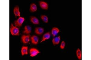 Immunofluorescent analysis of A549 cells using ABIN7152690 at dilution of 1:100 and Cy3-congugated Goat Anti-Rabbit IgG (FARP1 抗体  (AA 1-300))