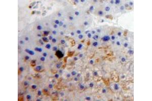 Used in DAB staining on fromalin fixed paraffin-embedded Liver tissue (CD11c 抗体  (AA 143-344))