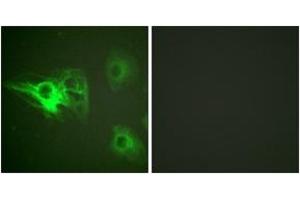 Immunofluorescence analysis of HeLa cells, using Keratin 8 (Phospho-Ser432) Antibody. (KRT8 抗体  (pSer432))