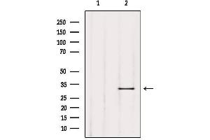 Western blot analysis of extracts from Mouse lung, using TRIO Antibody. (TRIO 抗体  (Internal Region))