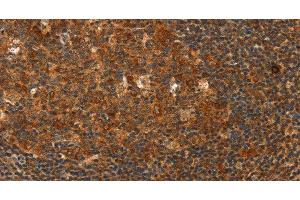 Immunohistochemistry of paraffin-embedded Human tonsil using HDAC8 Polyclonal Antibody at dilution of 1:40 (HDAC8 抗体)