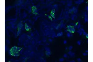 Image no. 1 for anti-Keratin 7 (KRT7) antibody (ABIN335336) (Cytokeratin 7 抗体)