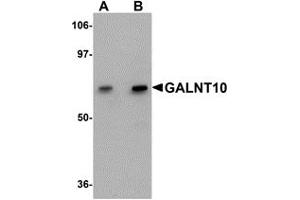 Western Blotting (WB) image for anti-UDP-N-Acetyl-alpha-D-Galactosamine:polypeptide N-Acetylgalactosaminyltransferase 10 (GalNAc-T10) (GALNT10) (C-Term) antibody (ABIN1030404) (GALNT10 抗体  (C-Term))