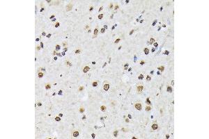 Immunohistochemistry of paraffin-embedded mouse spinal cord using Matrin 3 Rabbit mAb (ABIN7268414) at dilution of 1:100 (40x lens). (MATR3 抗体)