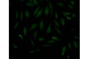 Immunofluorescence staining of Hela Cells with ABIN7127607 at 1:50, counter-stained with DAPI. (Recombinant MAD2L2 抗体)