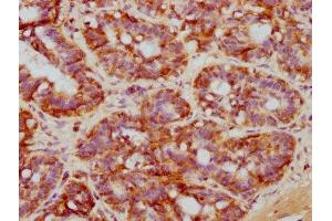 IHC image of ABIN7127637 diluted at 1:71. (Recombinant NDRG1 抗体)