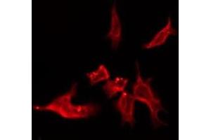 ABIN6276151 staining Hela by IF/ICC. (OR4C15 抗体  (C-Term))