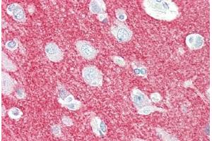 Human Brain, Cortex (formalin-fixed, paraffin-embedded) stained with CRMP1 antibody ABIN461920 at 5 ug/ml followed by biotinylated goat anti-rabbit IgG secondary antibody ABIN481713, alkaline phosphatase-streptavidin and chromogen. (CRMP1 抗体  (N-Term))