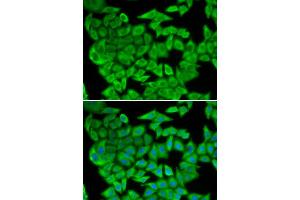 Immunofluorescence (IF) image for anti-Malate Dehydrogenase 2, NAD (Mitochondrial) (MDH2) antibody (ABIN1980313) (MDH2 抗体)
